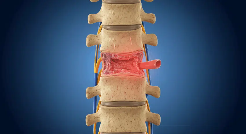 Common Causes and Types of Spinal Cord Injuries